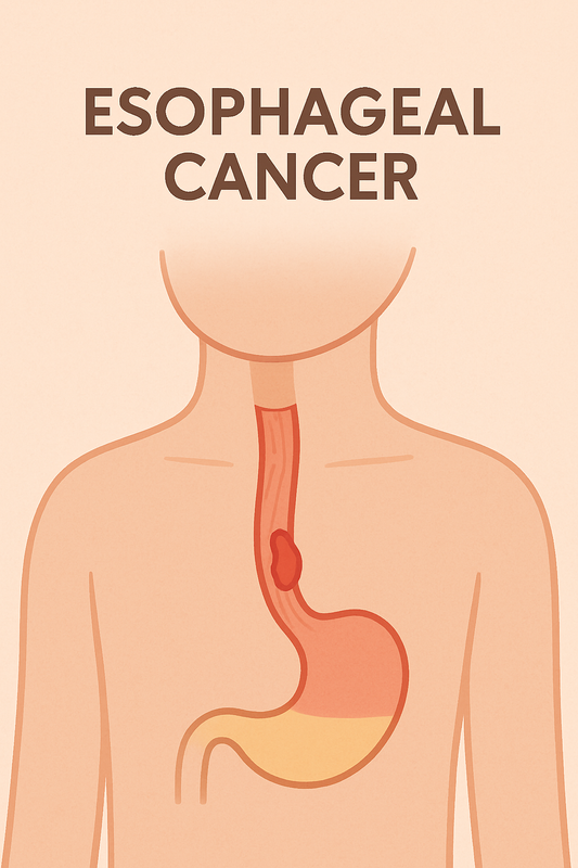 Understanding Esophageal Cancer: Symptoms, Causes, and Early Detection